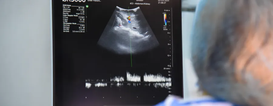 84 de donatori și aproape 300 de transplanturi în România în 2024